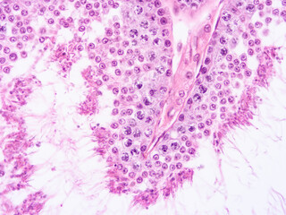 histology human tissue with microscope from laboratory (not Illustration Designation)