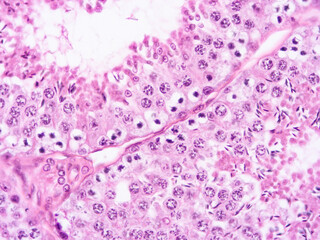 histology human tissue with microscope from laboratory (not Illustration Designation)