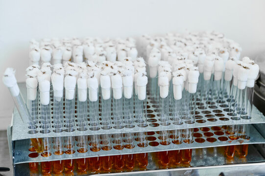 Test tubes with bacteriological cultures installed in tripod