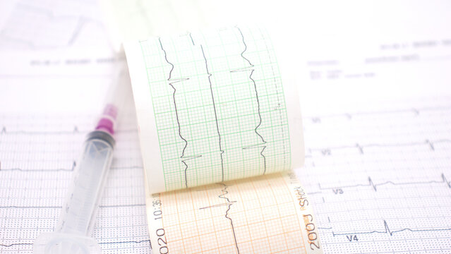 heart rhythm ekg note on paper doctors use to analyze heart disease treatment illustration on a white background