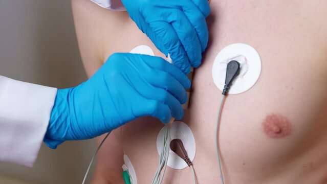 The doctor uses a Holter device to monitor the patient's heart electrocardiogram on a daily basis.