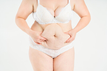 Tummy tuck, flabby skin with stretch marks on a fat belly, plastic surgery concept on light gray background