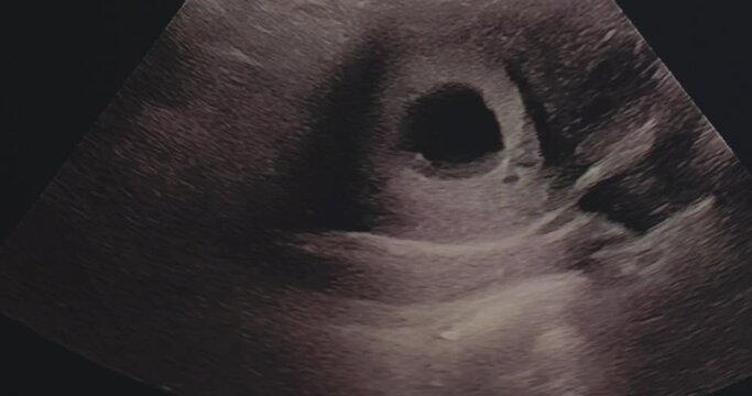 Ultrasound of an 8-week-old fetus in a mother's womb. 4K footage.