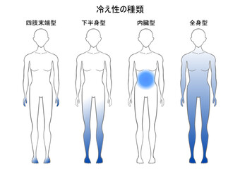 冷え性の種類