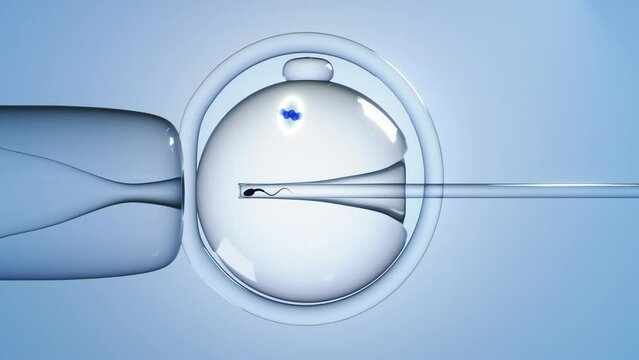 3D animation of Piezo-ICSI performed with spindle visualization. In vitro fertilization. Sperm injection using the piezo device. 