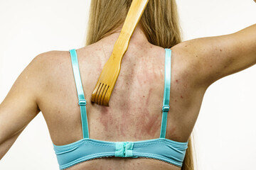 Woman scratching her itchy back using scratcher