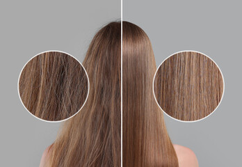 Photo of woman divided into halves before and after hair treatment on grey background, back view. Zoomed area showing damaged and healthy strand