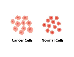 Normal vs Cancer Cell Division. Loss of normal growth control of cell. Mutation of cell vs Cell apoptosis