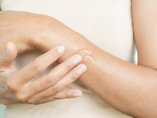 Fototapeta na wymiar Testing Gel Aloe Vera Skin Cream Apply Body Hand Woman, Serum Mask Moisture Medical Injury