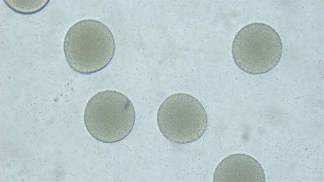 Sperm and ovule sea urchin Strongylocentrotus pallidus under microscope, phylum Echinodermata. White sea