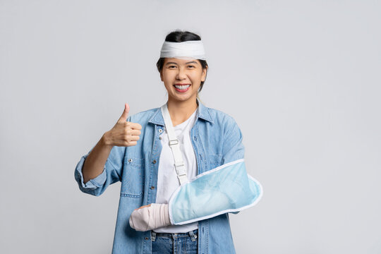 Smiling asian woman with broken head and wearing soft cast due to broken arm while showing thumbs up isolated on white background. Medical expenses concept.