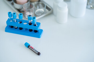 lab technician with a tube of blood samples and a rack with other samples lab technician holding blood tube sample for the study.