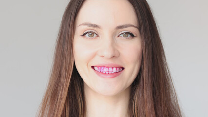 Disclosing tablets for dental plaque. Close-up of a woman's teeth. Pink tablet for detecting bacterial plaque