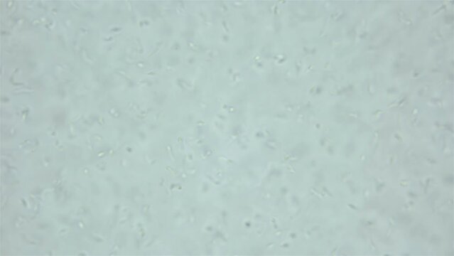 Sperm sea urchin Strongylocentrotus pallidus under microscope, phylum Echinodermata. White sea