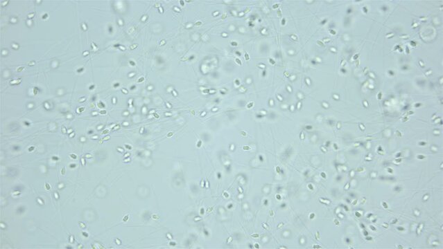 Sperm of Worm Polychaeta Nereis virens (Alitta virens) under microscope, family Nereididae. White Sea