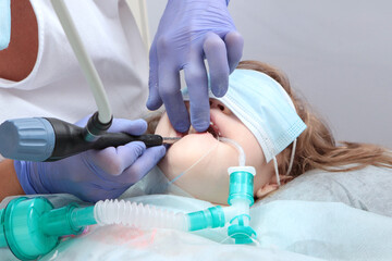 Treatment of baby teeth under anesthesia. Baby teeth. Modern dentistry.Close-up.