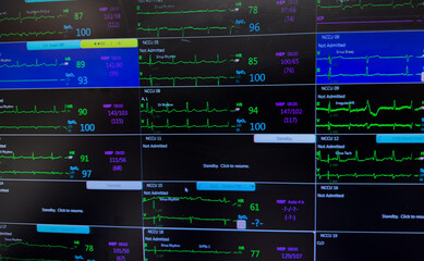 Hospital monitor displays vital signs: heart rate, blood pressure, EKG, and oxygen levels, symbolizing patient health