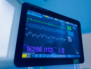 Hospital monitor displays vital signs: heart rate, blood pressure, EKG, and oxygen levels, symbolizing patient health