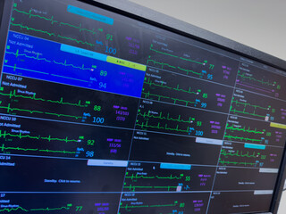 Hospital monitor displays vital signs: heart rate, blood pressure, EKG, and oxygen levels, symbolizing patient health