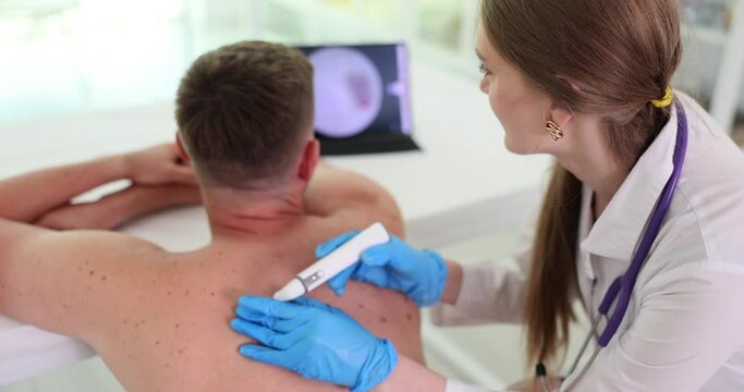 Dermatoscopy of moles, doctor examines patien back. Medical examination at oncology dermatology clinic