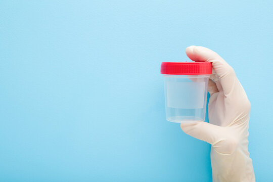 Doctor hand in white rubber protective glove holding transparent plastic container for urine or other analysis test on light blue background. Pastel color. Closeup. Empty place for text. Front view.