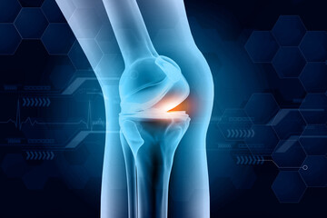 Human knee pain concept. 3d illustration. - obrazy, fototapety, plakaty
