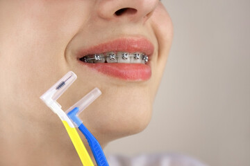 Portrait of a young girl with braces. Orthodontics, dentistry.