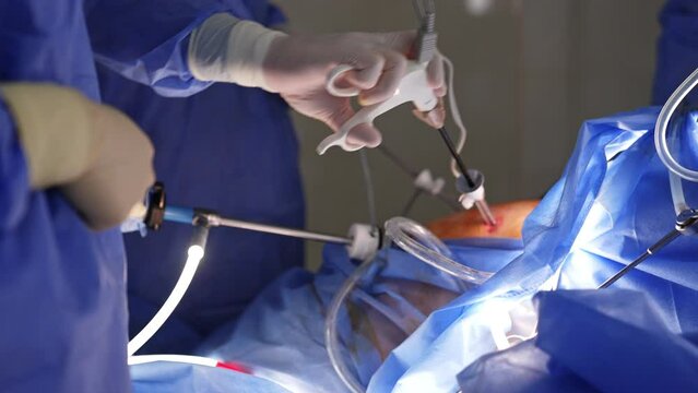 Unrecognized doctors using modern tools to perform laparoscopic operation. Hands of surgeons apply devices in procedure.