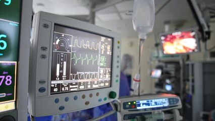 Curved lines running on the monitor of artificial lung machine. Equipment helping to control patient's condition at operation. Blurred backdrop.
