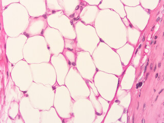 picture of histology human tissue with microscope from laboratory (not Illustration Designation)