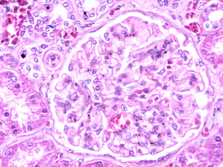 picture of histology human tissue with microscope from laboratory (not Illustration Designation)