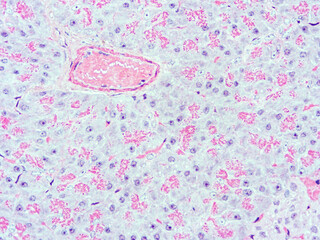 picture of histology human tissue with microscope from laboratory (not Illustration Designation)