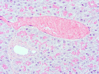 picture of histology human tissue with microscope from laboratory (not Illustration Designation)