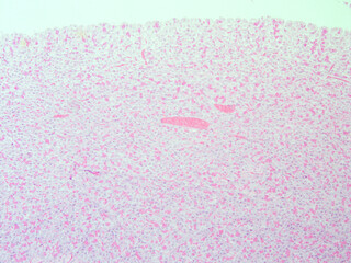 picture of histology human tissue with microscope from laboratory (not Illustration Designation)