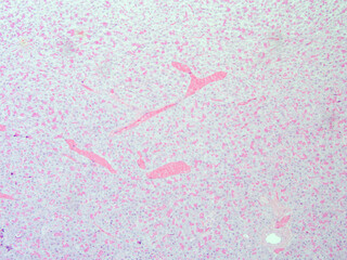 picture of histology human tissue with microscope from laboratory (not Illustration Designation)