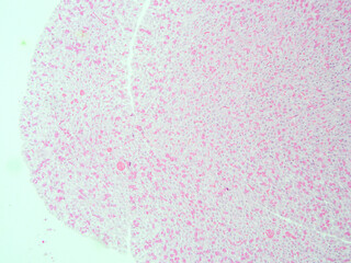 picture of histology human tissue with microscope from laboratory (not Illustration Designation)