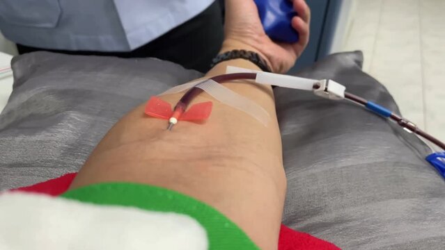 
Some blurry Footage of the hand and the platelet apheresis. blood. 4k