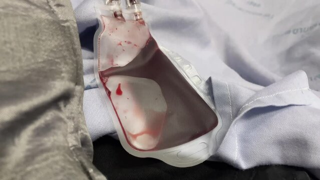 Some blurry Footage of the platelet apheresis. blood. 4k