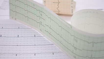heart rhythm ekg note on paper doctors use to analyze heart disease treatment illustration on a...