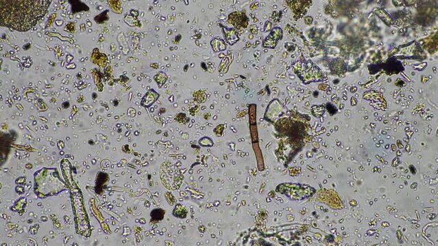 soil microorganisms close up under the microscope. in a soil samlple from a farm