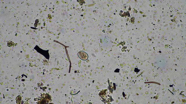 soil microorganisms close up under the microscope. in a soil samlple from a farm