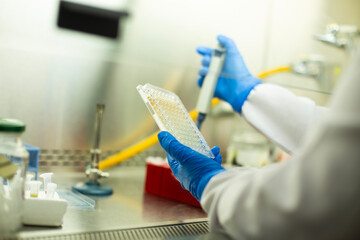 cell culture at the medicine, medical and biology laboratory, cancer science experiment at the...