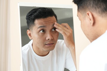 Obraz premium Photo of anxious Asian young man looking in the mirror worried about wrinkles or acne on unhealthy skin.