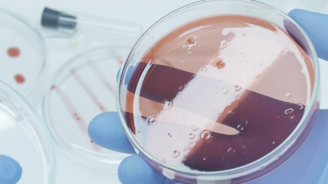 Fungus and mold. Bacteria culture growth on a petri dish in microbiology lab. Candida auris. Microbial cultures growth on selective media plate in microbiology laboratory. Biomarker. Bio-reagent. 