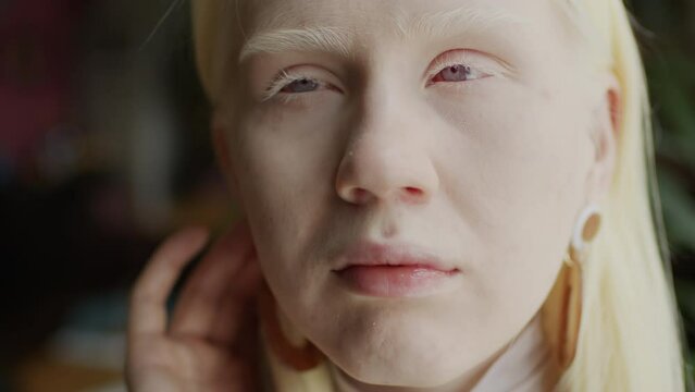 Close-up portrait of young albino woman with no makeup tucking strand of hair behind her ear