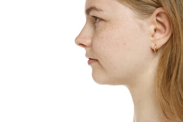 Closeup profile of a young woman's face, mouth, nose and cheek on a white background