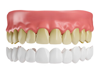 Realistic teeth with lenses and gums in on transparent background in 3d render 