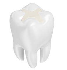 Teeth with restorations in on transparent background in 3d render 