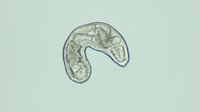 Parasitic Trematoda worm under microscope, possibly Brachyphallus crenatus. Stage of development of mature larva is Metacercaria. White sea