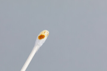 Earwax on cotton swab. Ear health, problems, cleaning and hearing loss concept.